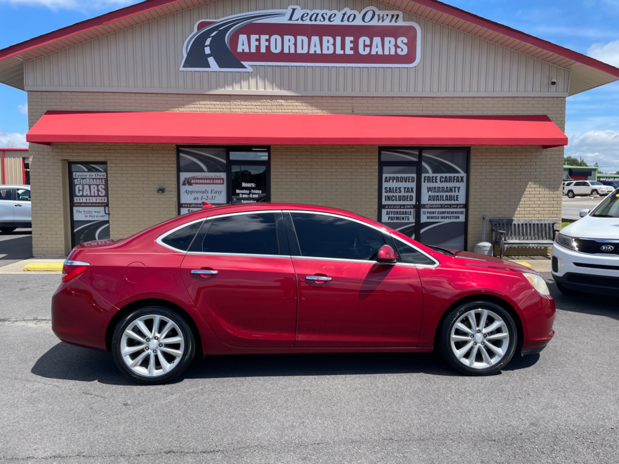 photo of 2014 Buick Verano